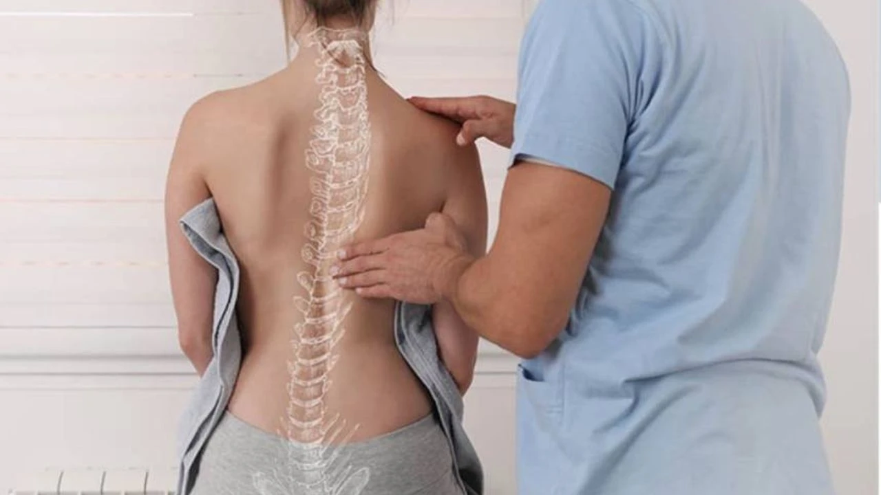 Skolyoz Rehabilitasyonu